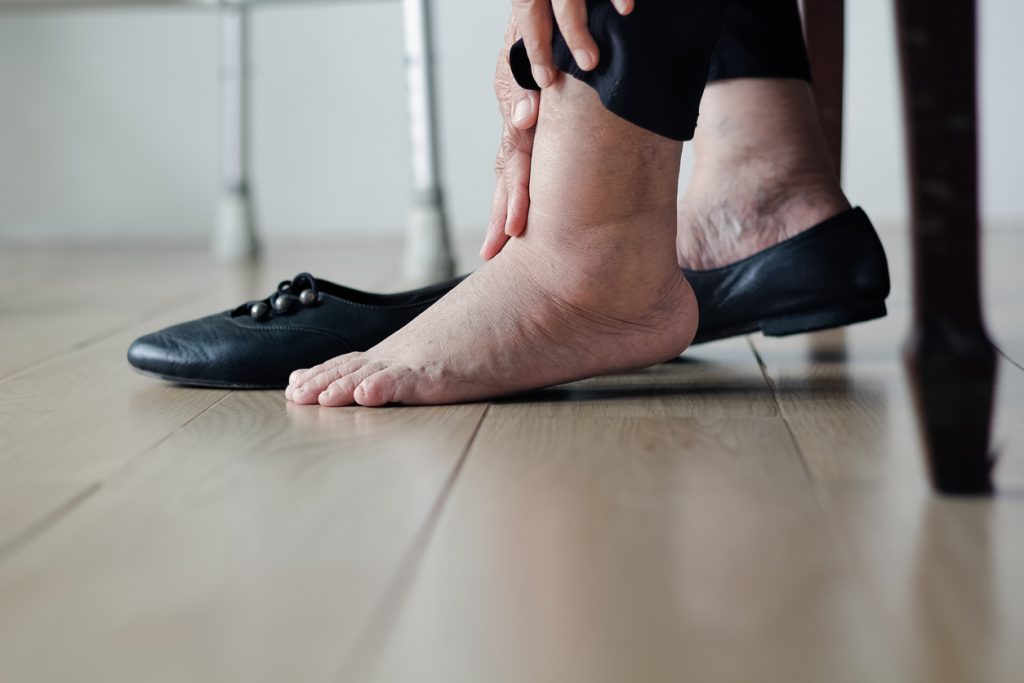 Diabetic care includes wearing the proper shoes and footwear.